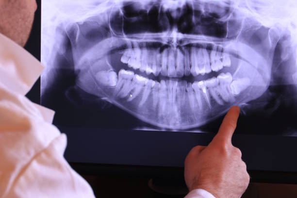 Best Weekend Emergency Dentist in North Manchester, IN