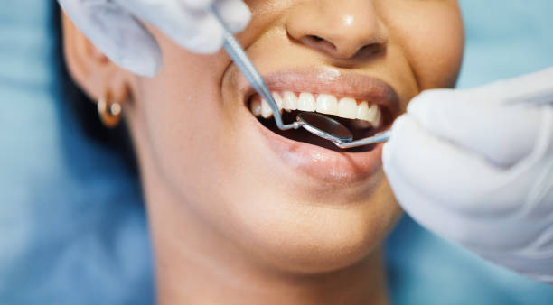 Best Emergency Tooth Extraction in North Manchester, IN